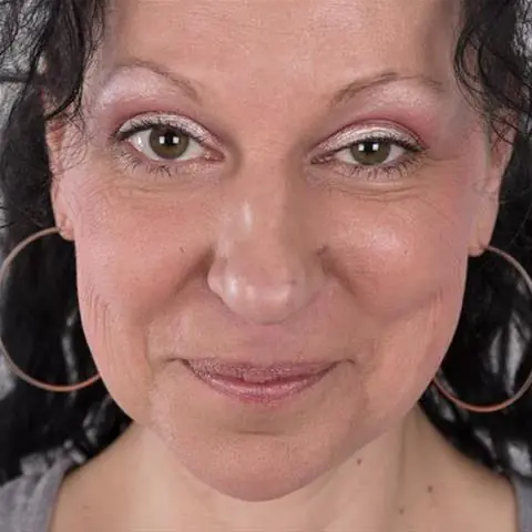 Informacja101 image 1